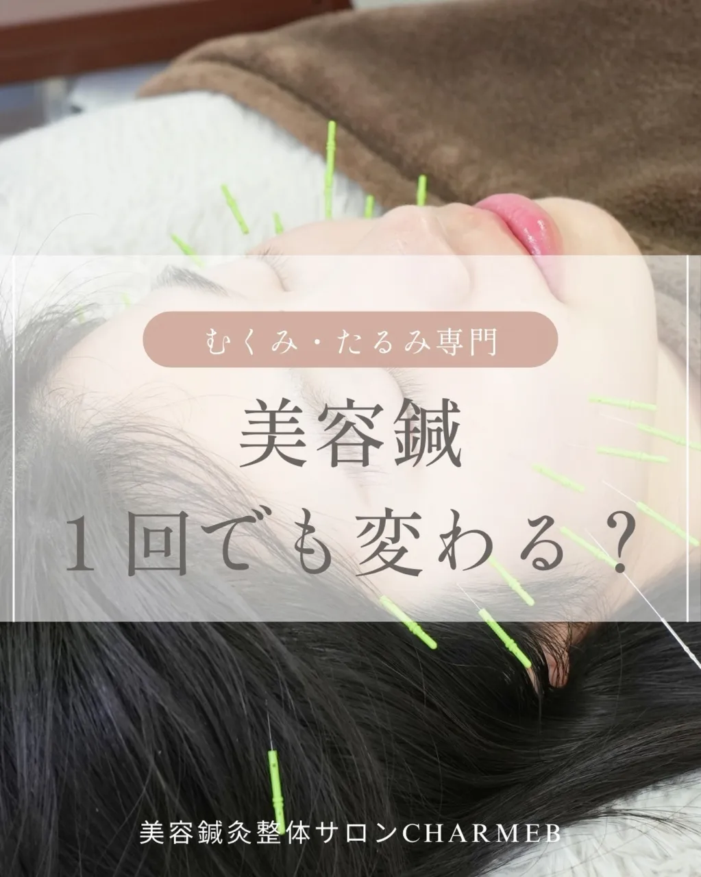 「美容鍼って何回受ければいいですか?」